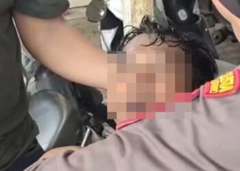 I Nengah Candra Irawan, korban tindakan represif aparat keamanan dalam menangani aksi damai yang digelar oleh Aliansi Masyarakat Peduli Petani Singkong Indonesia di depan Kantor Gubernur Lampung, Senin (5/5/2025).