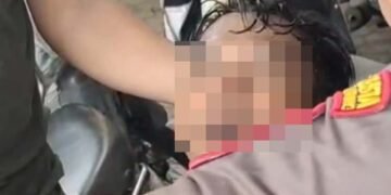 I Nengah Candra Irawan, korban tindakan represif aparat keamanan dalam menangani aksi damai yang digelar oleh Aliansi Masyarakat Peduli Petani Singkong Indonesia di depan Kantor Gubernur Lampung, Senin (5/5/2025).